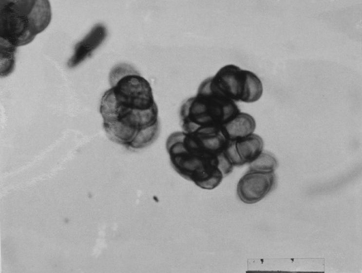 Представитель Семейства Clintamraceae